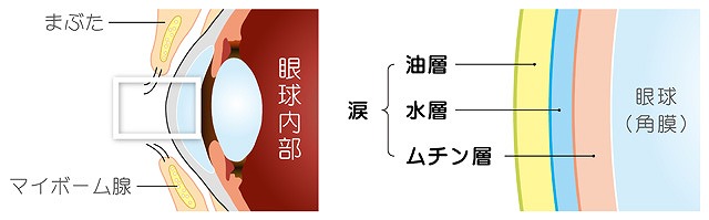 マイボーム腺機能不全の治療