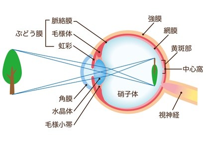 屈折異常