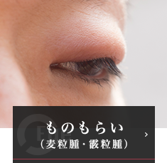 ものもらい（麦粒腫・霰粒腫）