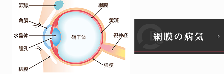 網膜の病気